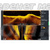 Датчик Lowrance ActiveImaging HD 3-in-1 SideScan Fish Reveal