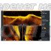 Датчик Lowrance Active Imaging HD 3-in-1